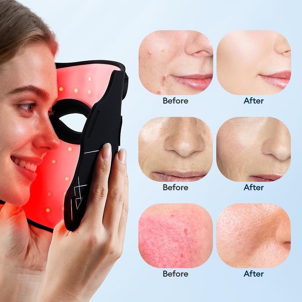 7 Colors LED Face Silicone Mask Flexible Facial Beauty LED Mask Photon Light Rejuvenation Anti-Wrinkle Skin Care Wireless Use
