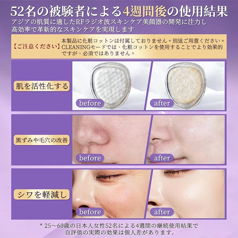 Facial Beauty Device [Supervised by Beauty Expert Suzuki] EMS RF Beauty Device 1 Unit 16 Roles 6 Types of Modes 3 Level Micro Current 3 Color LED