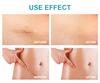 1pc Deep Whitening and Removing Freckles Melasma and Dark Spots Melanin Gel Whitening Facial Skin Care Aging Body Care