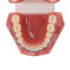 Dental Orthodontic Model 28pcs Teeth Resin Dental Teaching Teeth Model with Metal Braces