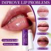 Refreshing Fruit Moisturizing Multi-color Mixed Lip Balm To Prevent Dryness and Hydration To Deeply Moisturize Lips