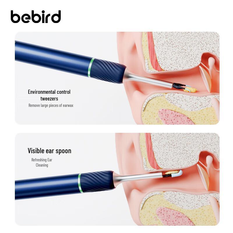 Bebird Note5 Pro Smart Visual Ear Spoon