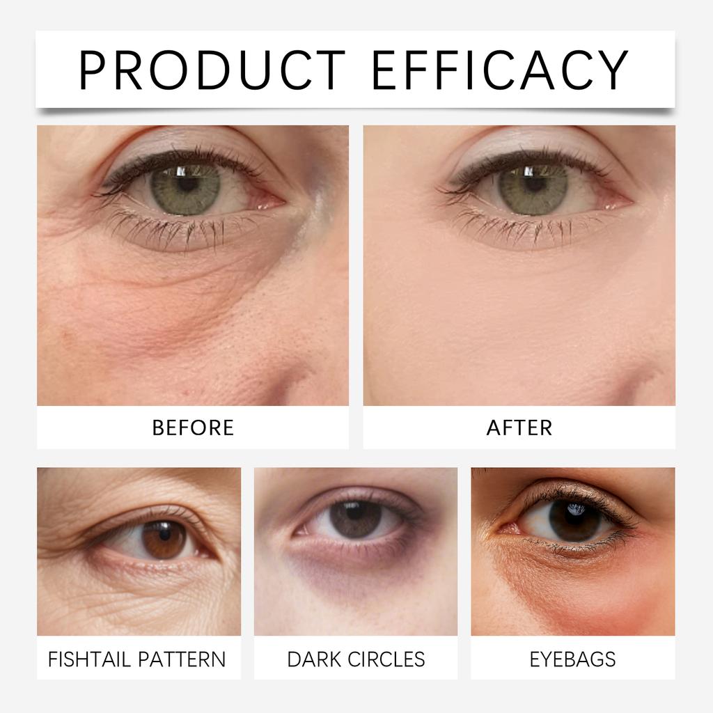Brightening Eye Cream for Dark and Puffiness