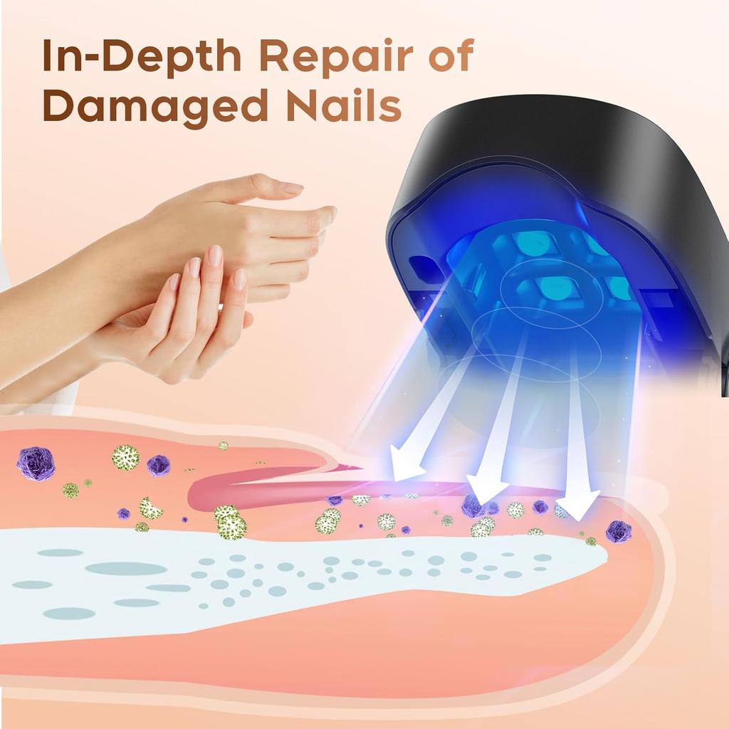 Nail Fungus Cleaning Laser Light, Used For Onychomycosis, USB Charging 905nm Infrared Light 470nm Blue Light