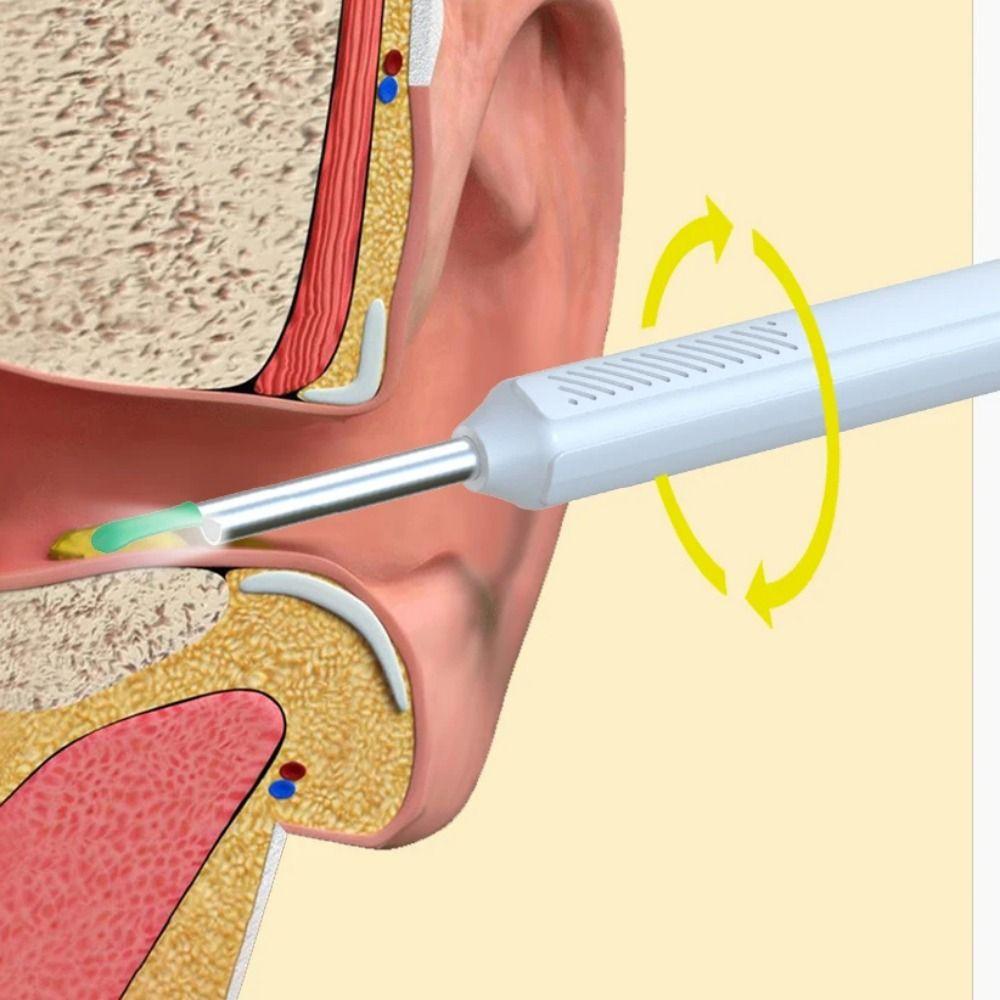 HD Camera Visual Ear Cleaner Wireless WiFi Wireless Otoscope Ear Cleaning Tools  Ear Cleaning