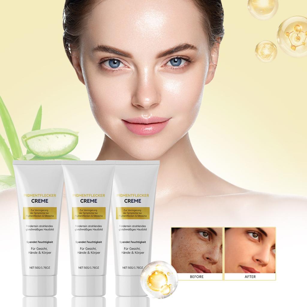 Pigmentation Cream, Whitening Moisturizer Reduces Melanin Deposition And Improves Uneven Skin Tone(1pc