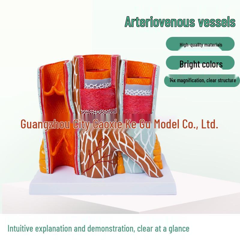 Zhenghe Human Vascular Model for Teaching and Demonstration Magnified Size