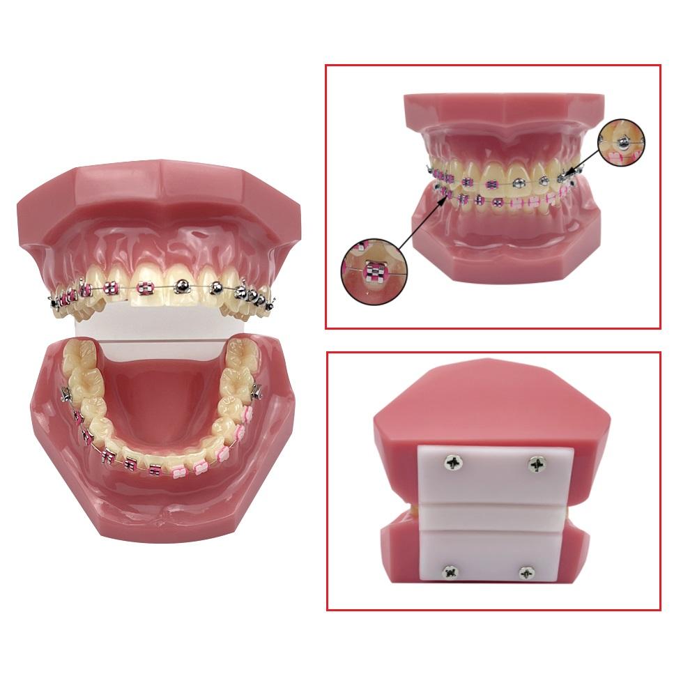 Dental Orthodontic Teeth Model Metal Ceramic