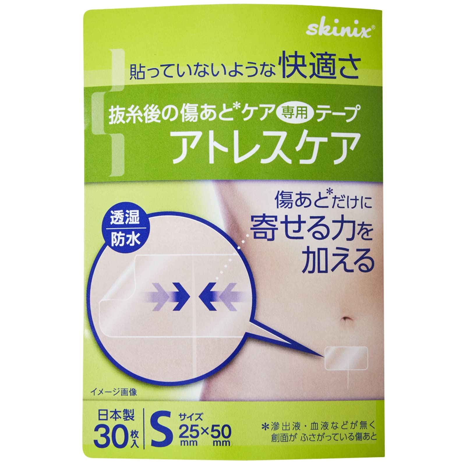 

Skinix Atrescare Scar Care 25 x 50 30 for Cesarean and Tape, mm, pieces, section, surgery, post-suture removal. (YB-Q2550S)