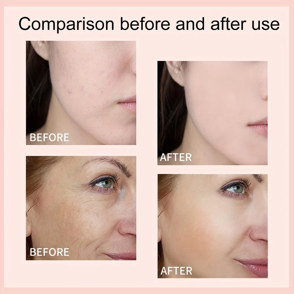 Hydrate & Rejuvenate - Hyaluronic Acid Face Serum for Soothing Dry Skin, Boosts Elasticity, Fights Acne, Erases Fine Lines