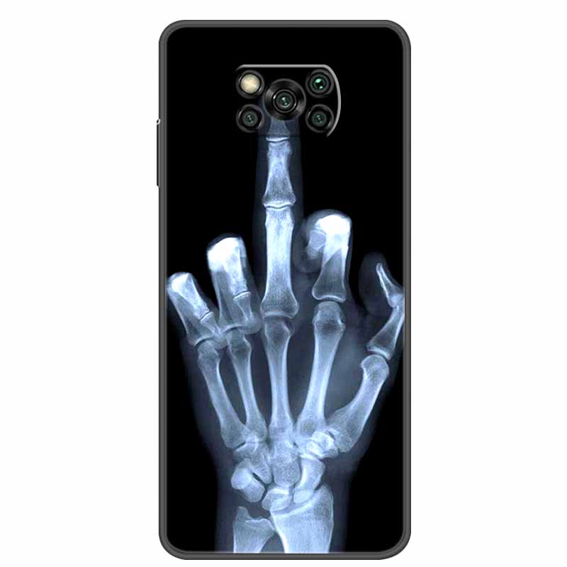 For Poco X3 Pro X3 NFC Case Fashion Soft TPU Silicone Back Cover For Xiaomi Poco X3 NFC Case Shockproof Coque PocoX3 X 3 X3Pro