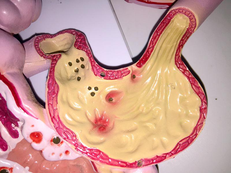 Human Digestive System Model: Large Intestine, Rectum, Duodenum, Stomach & Intestines Anatomical Structure