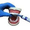 Dentalmaterial Ätzmittel 37% Phosphorsäure Ätzmittel Ätzgel Mit 5 Spitzen Für Kieferorthopädischen Klebstoff Lichthärtender Bond Zähne Kleber