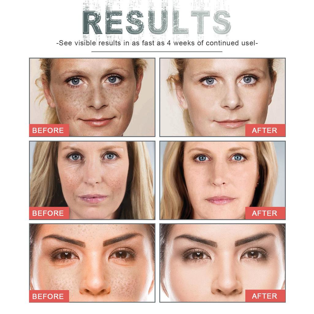 EELHOE CRÈME FIXANTE POUR LES RIDULES DU VISAGE Raffermissante Réparatrice Estompe les Pores