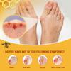 Bee Thumb Heat Care Massage Relieving Toe Muscle And Pain Promotes Blood Circulation A Plaster That Relieves Fatigue