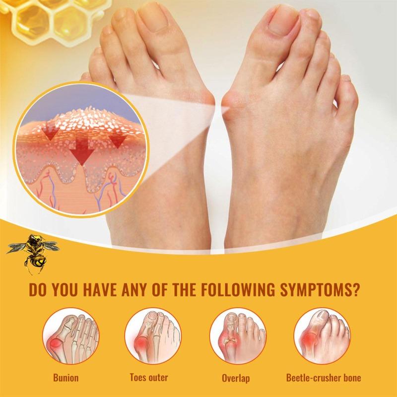 Bee Thumb Heat Care Massage Relieving Toe Muscle And Pain Promotes Blood Circulation A Plaster That Relieves Fatigue
