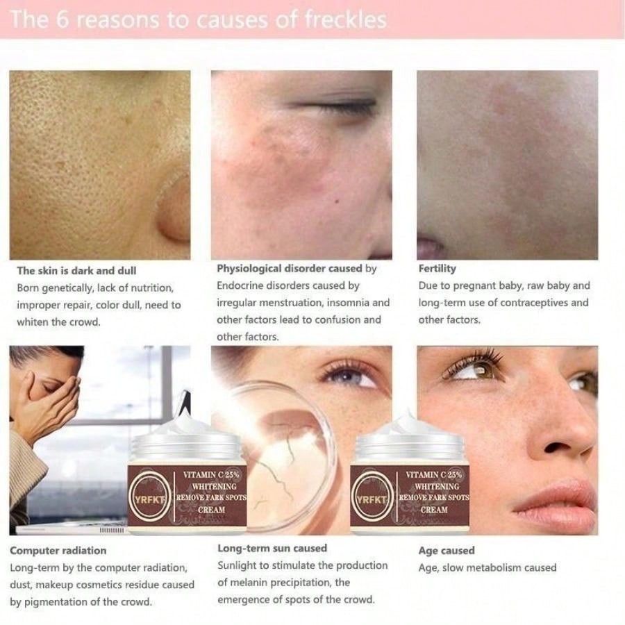 Women New Skin Brightening Cream&Freckle Cream&Dark Spot Corrector Remover for Face Blemishes