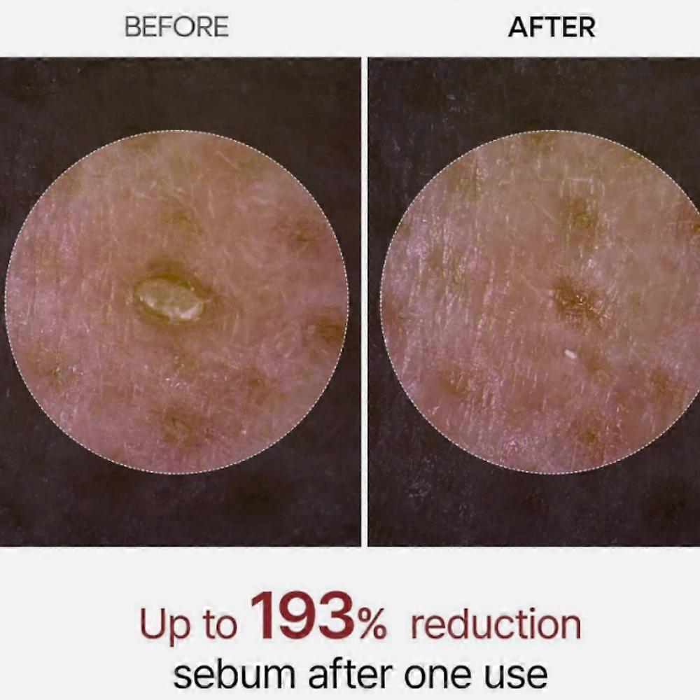 2 Stück Dr.Melaxin PEEL SHOT GLOW Peeling Reis Ampulle (WEISSER REIS/SCHWARZER REIS) 80 ml