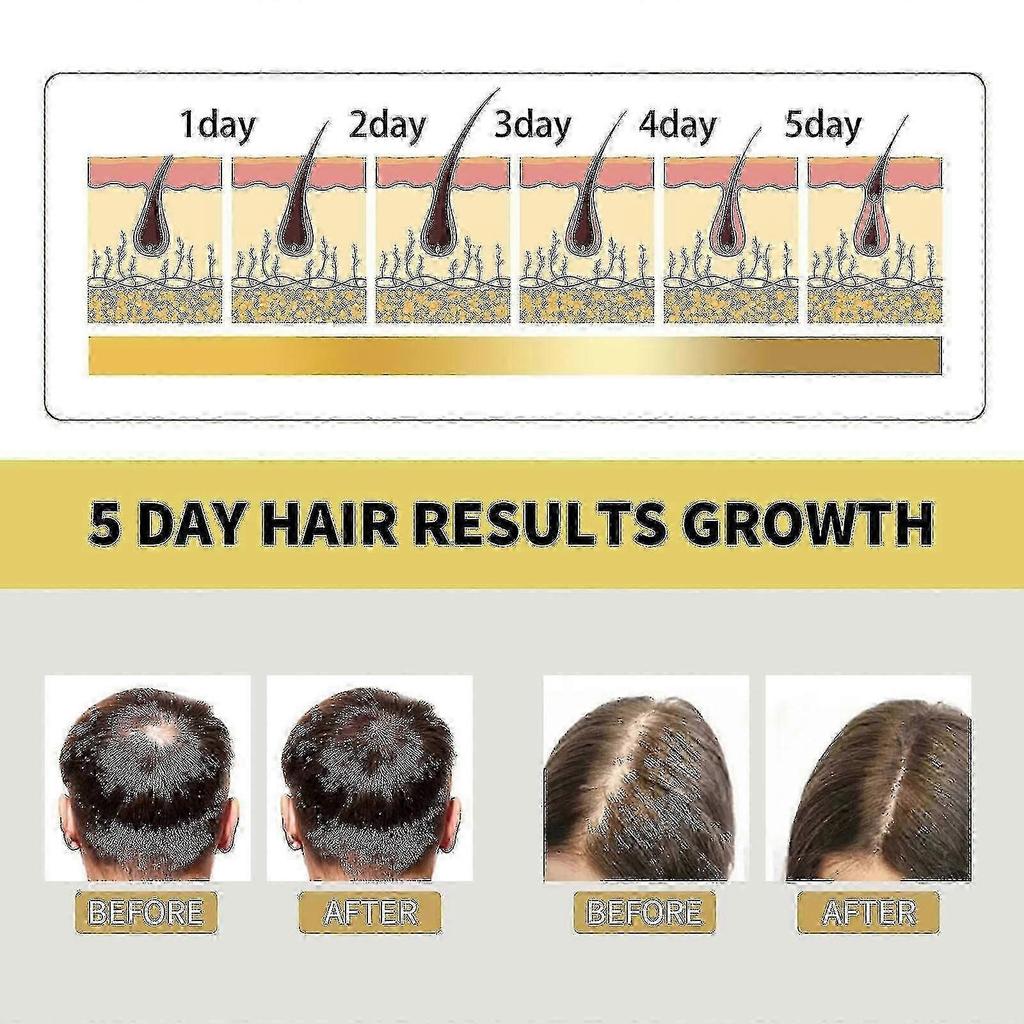 OUHOE Ginger Anti-itching Dense Hair Shampoo Hair Growth Moisturizing Solid Hair Dense Hair Fluffy Conditi