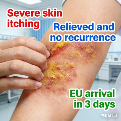 Anti-Itch Eczema Cream - Powerful Bacteria-Inhibiting Relieves Rash Redness Peeling