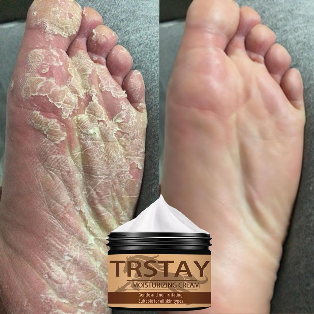 Ma You Hand and Foot Repair Cream replenishes moisture, repairs damaged foot skin, restores healthy foot skin, and moisturizes and protects the feet