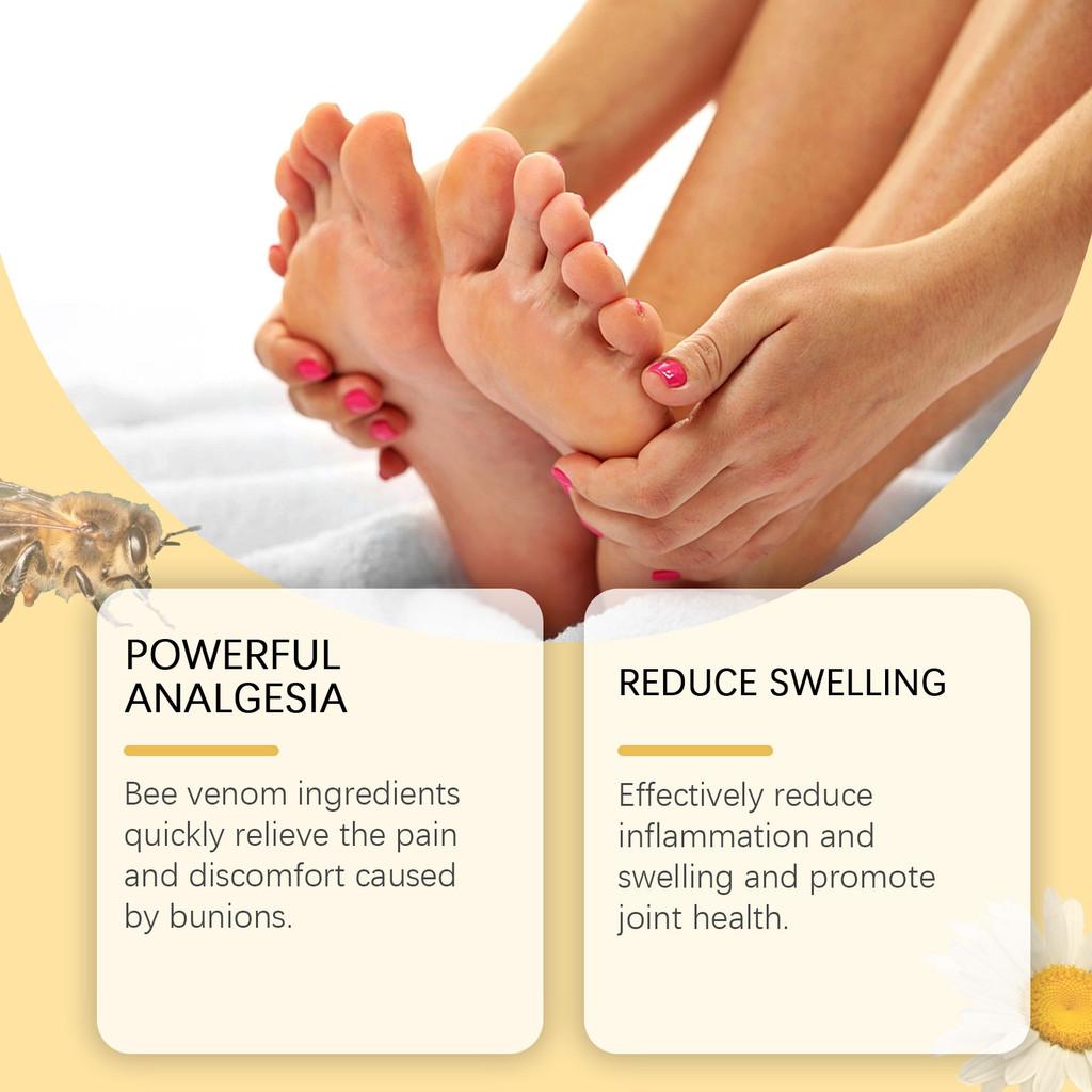 South Moon Bee Venom Care Cream For Correcting Swollen Feet And Joint Discomfort