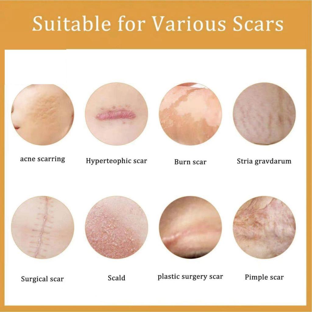 Smoothing Skin Stretch Mark Cream, Gentle and Non-irritating, Smooths Wrinkles and Fades Fine Lines