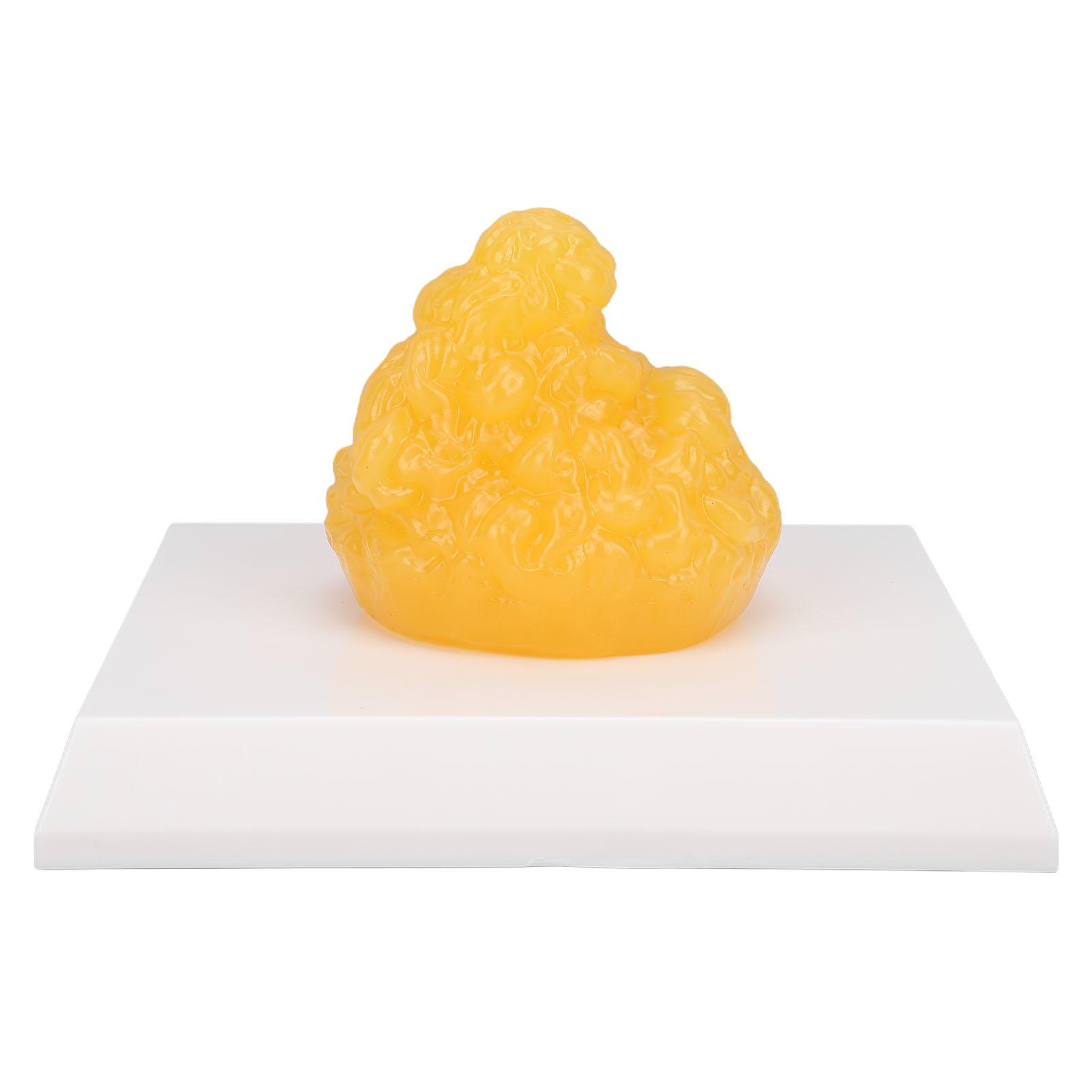 Human Body Fat Replica Human Fatty Tissue Demonstration Model Weight Reduction Motivation for Nutritionist Anatomical