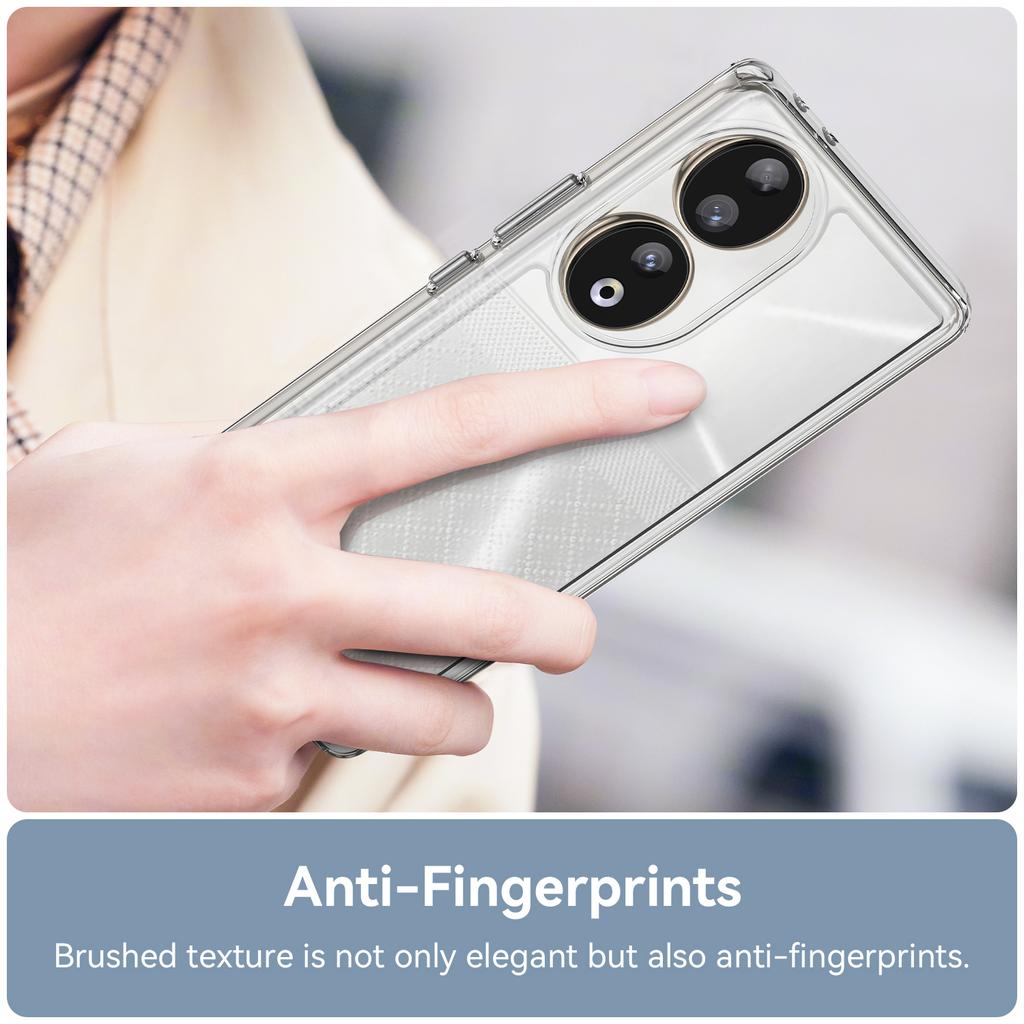 TPU+Acrylic Cover for Honor 90 Clear Phone Case with Electroplating Buttons (Big Rear Lens Hole)