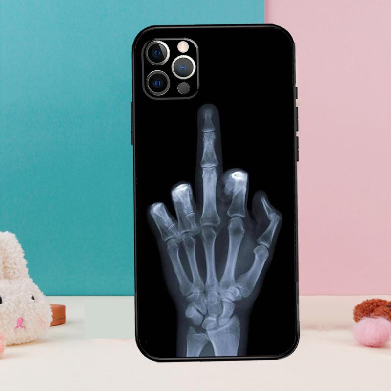 Skelett Mittelfinger Handyhülle Für iPhone 16 14 13 12 11 15 Pro Max 12 13 mini XR 15 16 Plus 16e Hülle Coque