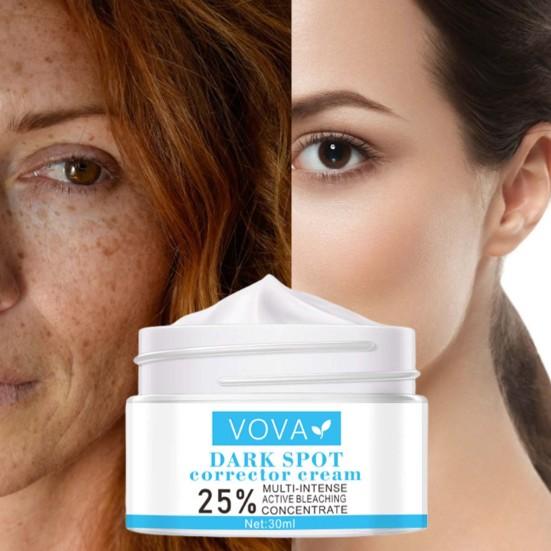 30ml Krem mot mørke flekker Multi-Intensiv Bleking Melanin Naturlig Ekstrakt Effektiv Pigmentfjerningskrem for Skjønnhet