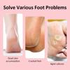 Electric Feet Sander Machine Rupture Skin Trimmer Dead Skin for Heels Foot Care Grinding Pedicure Tools Recharge Remover Callus