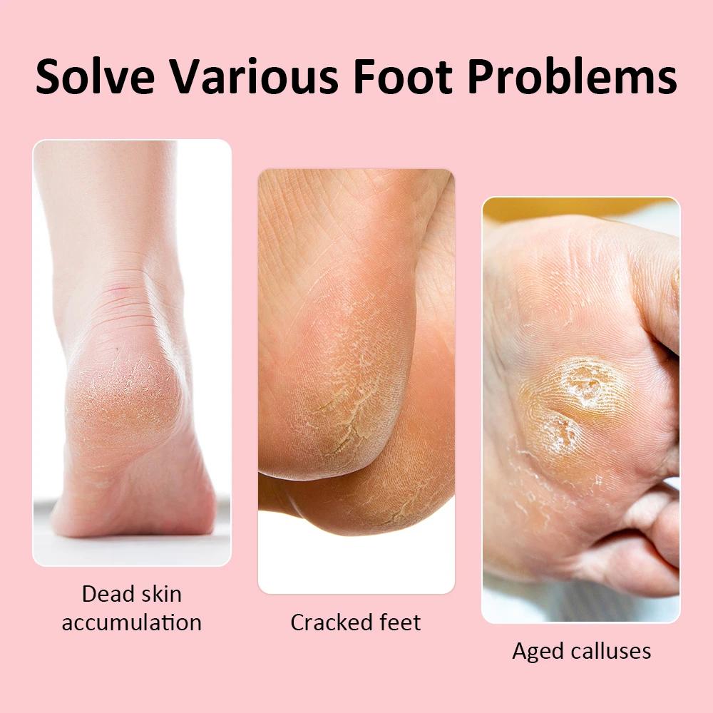Electric Feet Sander Machine Rupture Skin Trimmer Dead Skin for Heels Foot Care Grinding Pedicure Tools Recharge Remover Callus