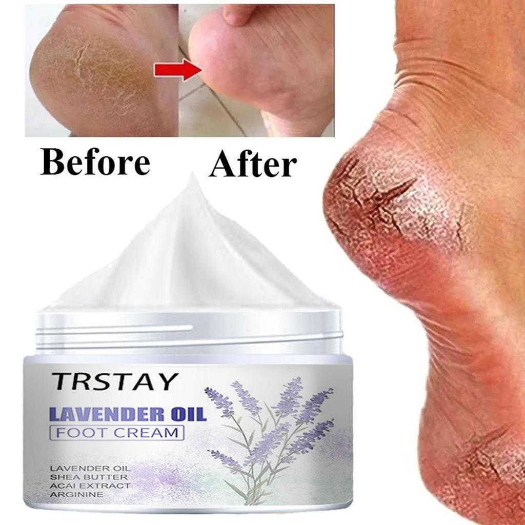 Gentle and Non-irritating, the Chapped Foot Repair Cream Hydrates and Nourishes the Skin, Leaving It Soft and Delicate