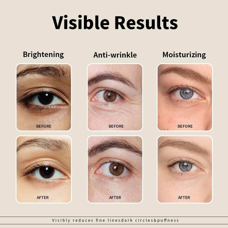 Exclusive Anti-Wrinkle Eye Cream: Firm, Sooth, and Remove Dark Circles & Eye Bags