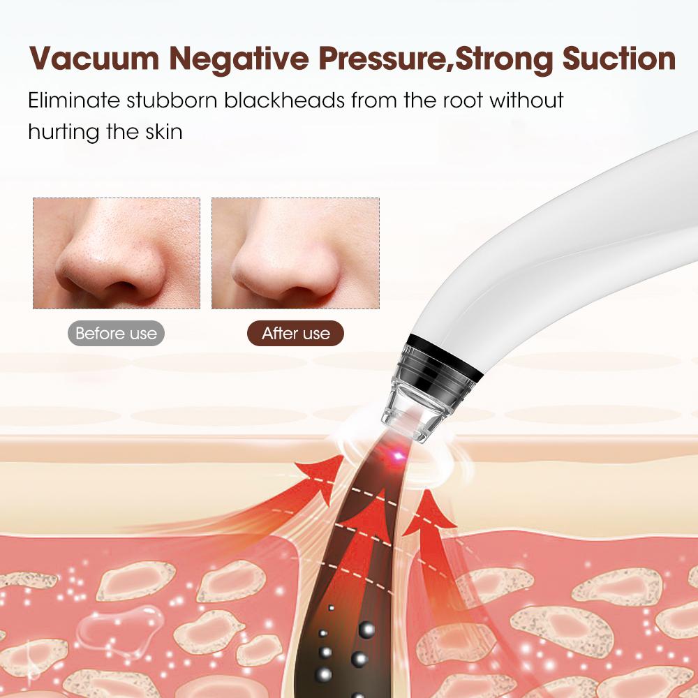App Visual Electric Blackhead Remover 3 Levels Suction Vacuum Acne Pore Cleaner Black Dots Extractor Facial Deep Clean Skin Care