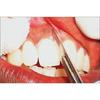 GDC Scalpel Handles (Bp Handle)