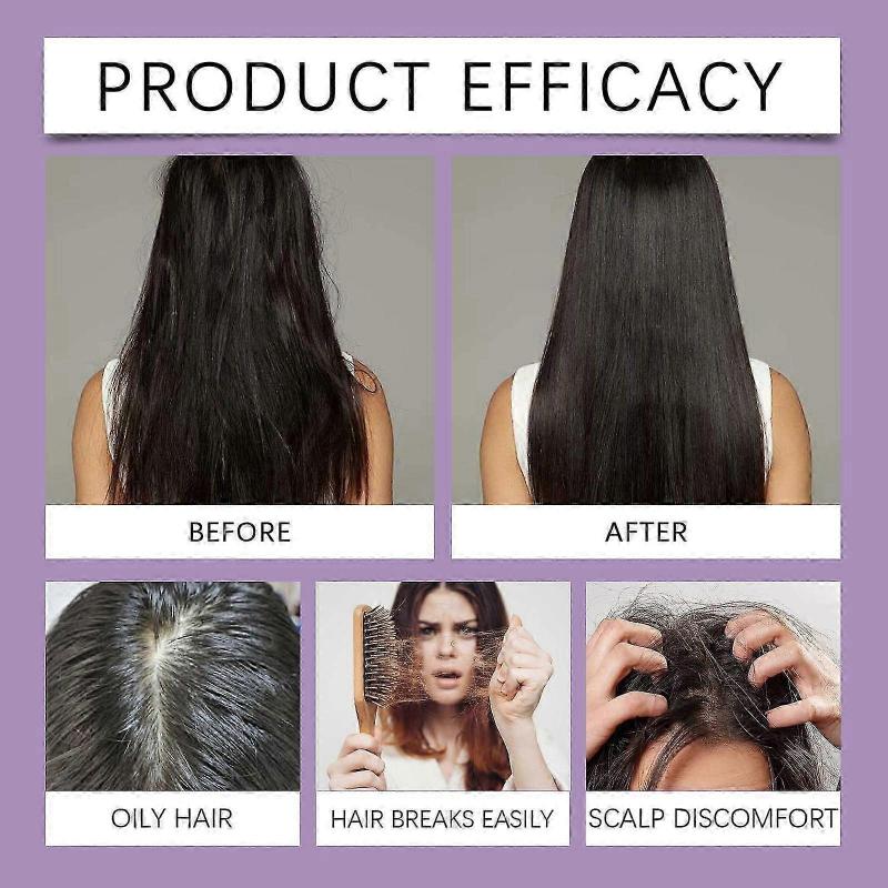 1-5x 100ml 5% Hair Growth Foam for Women, Hair Regrowth Treatment Serum for Thinning Hair & Receding Hairline, 100ml