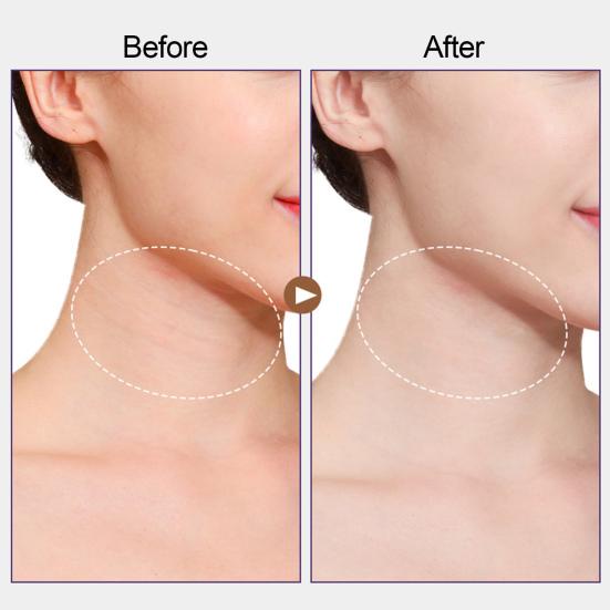5/20Pcs Lifting Neck Tape Breathable Smoothing Neck Firming Patch Invisible High