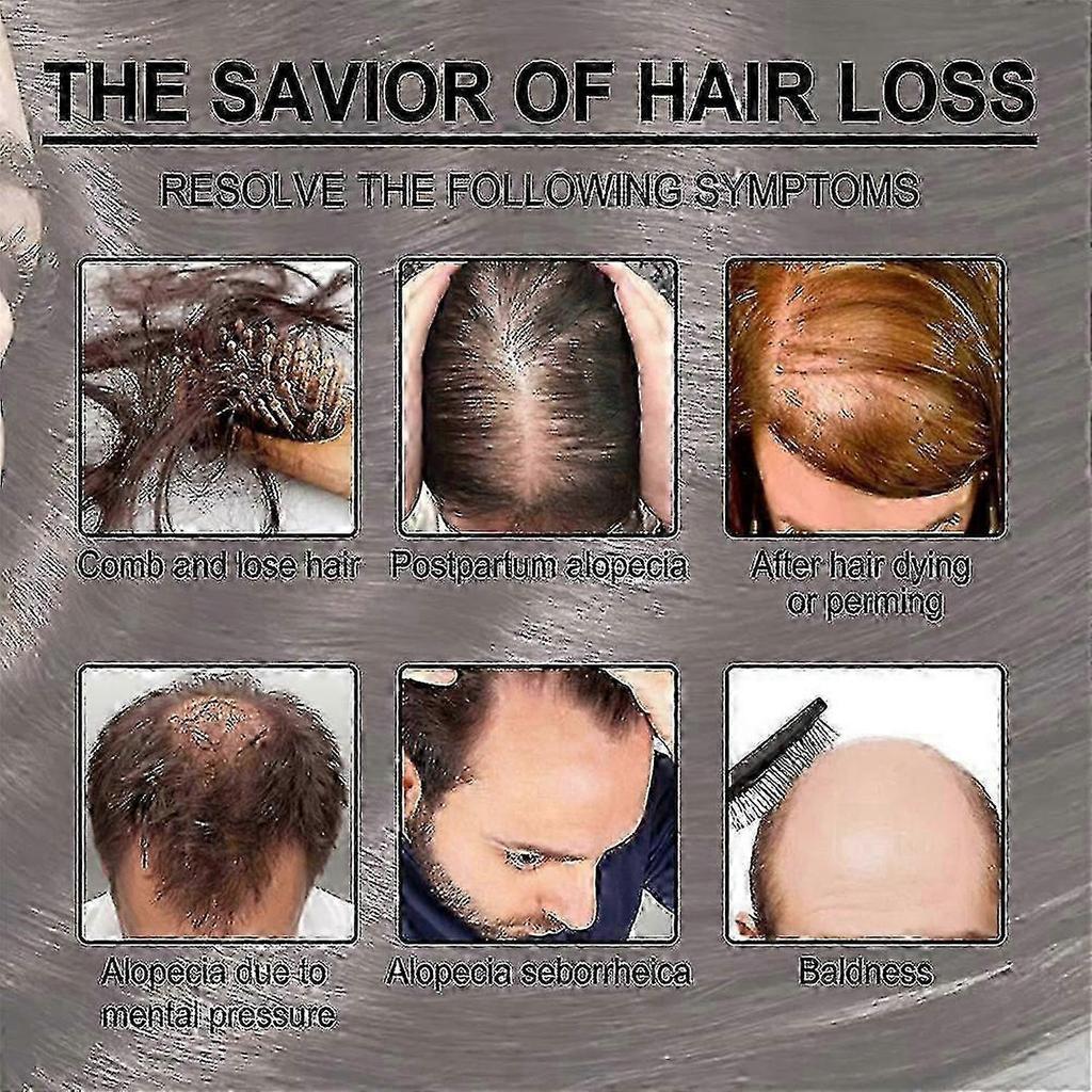 3x EELHOE Hair Oil For Dry Scalp Stimulates Hair Growth Hair Care Essential Oil Refreshing Firming Skin Rosemary Oil
