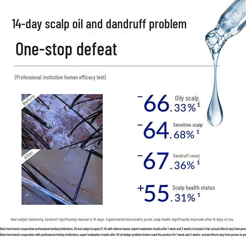 MantLing Anti-Dandruff & Oil Control Shampoo