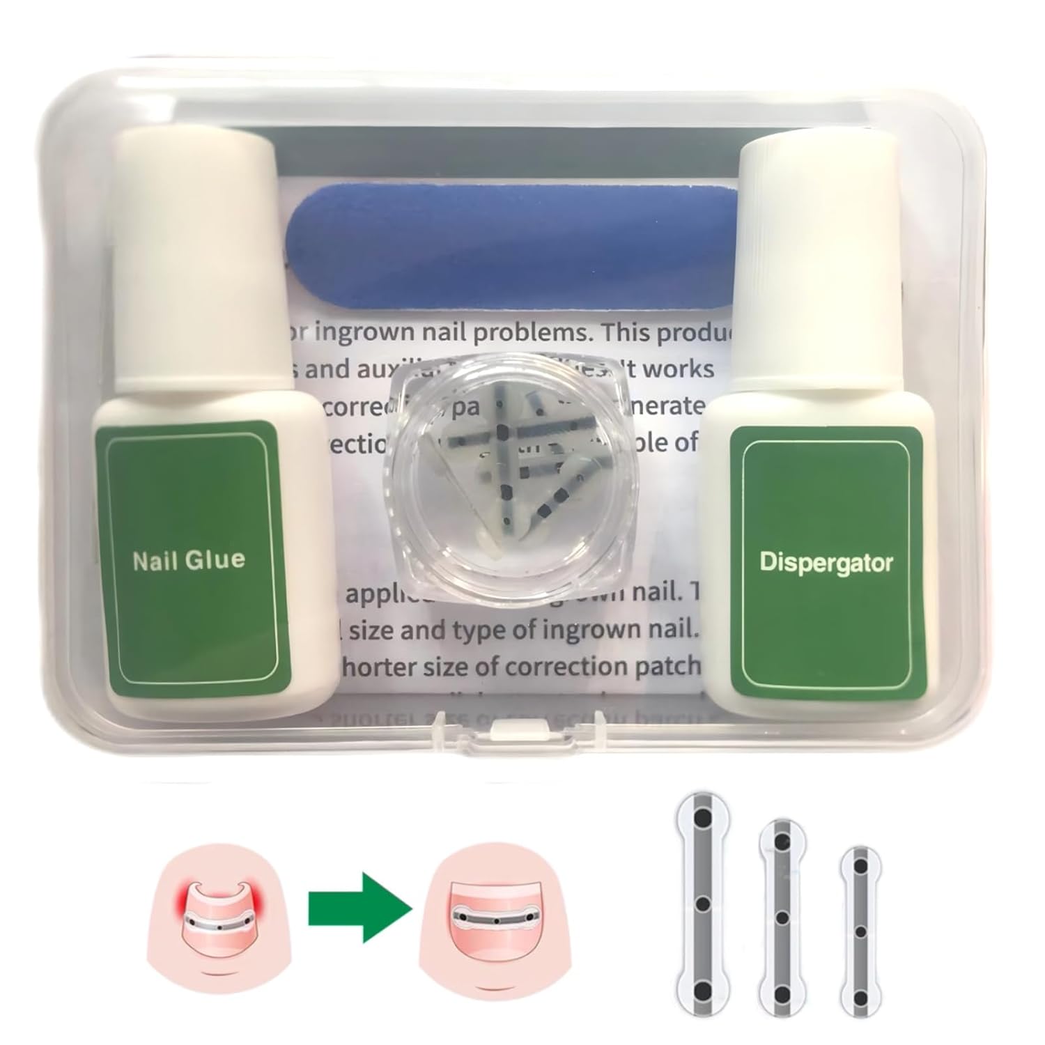 

Инструмент-пластырь для коррекции вросшего ногтя из титанового сплава и силикона, Лечение вросшего ногтя, Набор для удаления вросшего ногтя, Разработан для исправления изогнутых ногтей, ноготь