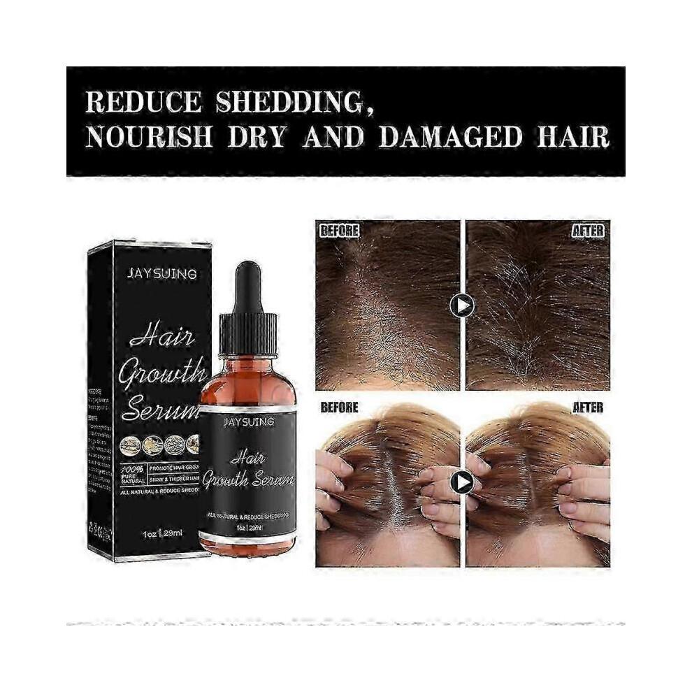 3pcs Noor Hair Growth Serum African Olives, Noor Love Hair Growth Serum