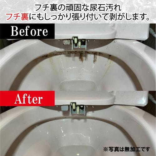 Sanki Professional Toilet Cleaner, Over 150,000 Bottles Sold, Used by Famous Hotels and Major Railway Companies, Restores Shine, Eliminates Stain, and