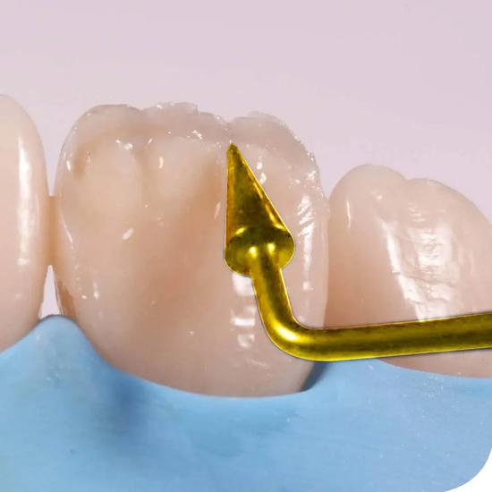 GDC Composite Instrument Gold Titanium - 6 CIG3