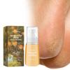 Moisturizing Foot Spray for Dry Heels
