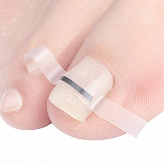 Yousheng Titanium Alloy Ingrown Toenail Corrector Kit for Curved Nail Repair Ingrown Toenail Treatment Tool Toe Nail Straightener