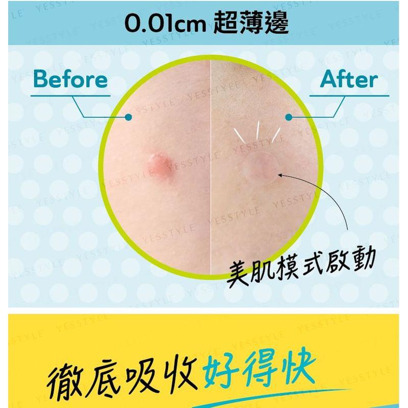 DermaAngel - Denní náplasti na akné s kyselinou salicylovou Plus 24 ks