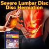 Lumbar Disc Herniation Rehabilitation Plaster To Relieve Waist and Leg Pain Caused by Lumbar Process