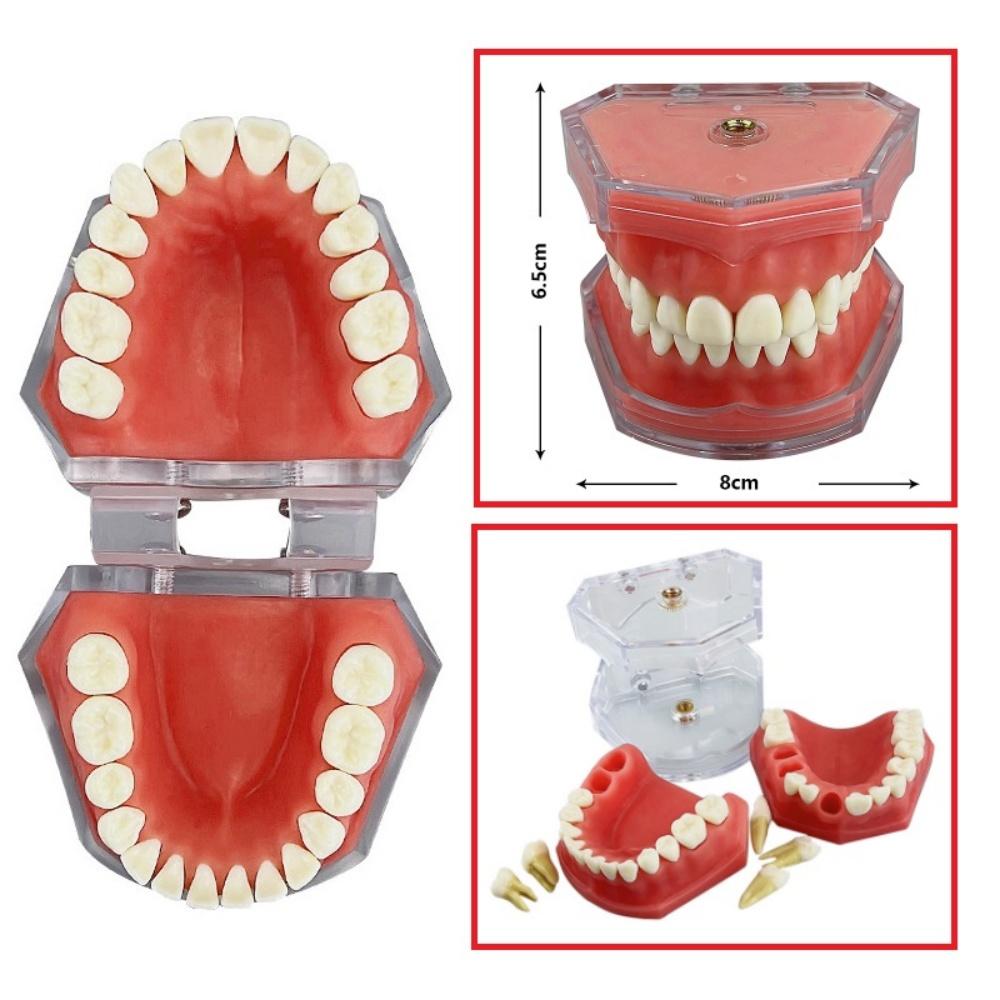 Modello Typodont Standard Dentale Con 28 Denti Rimovibili Gengiva Morbida Modello per Esercitazione Estrazione Dentale Per Educazione Paziente Demo Nuovo